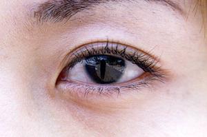 心斎橋でも人気の二重整形ならこちら