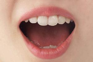 自然な形で小鼻縮小できる仙台の美容外科